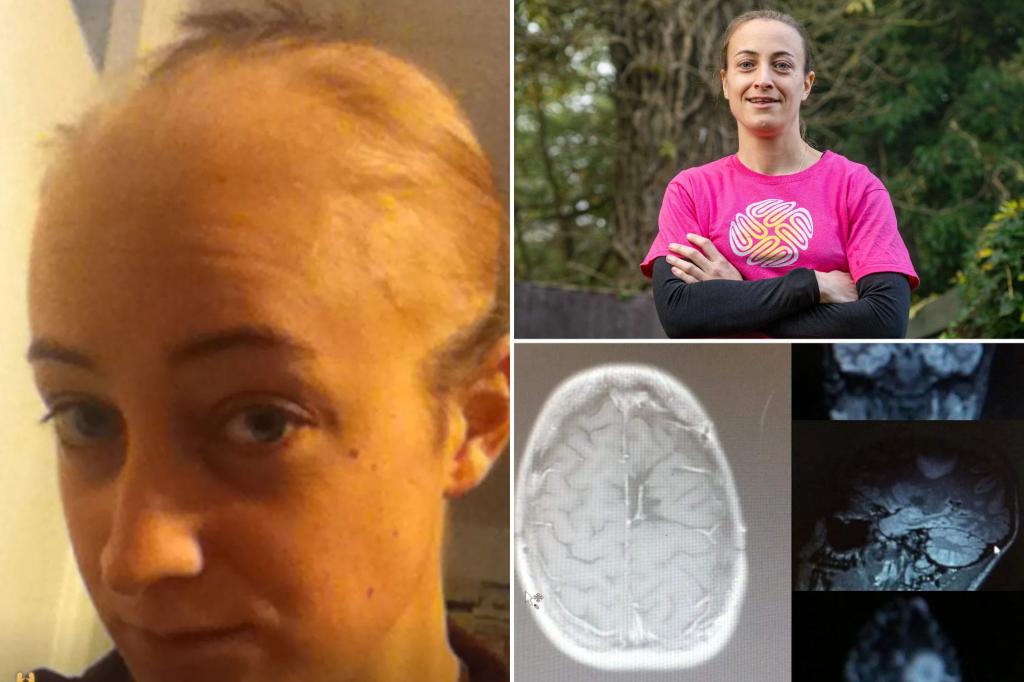 My doctors thought I fainted because I was afraid of spiders - I actually had brain cancer