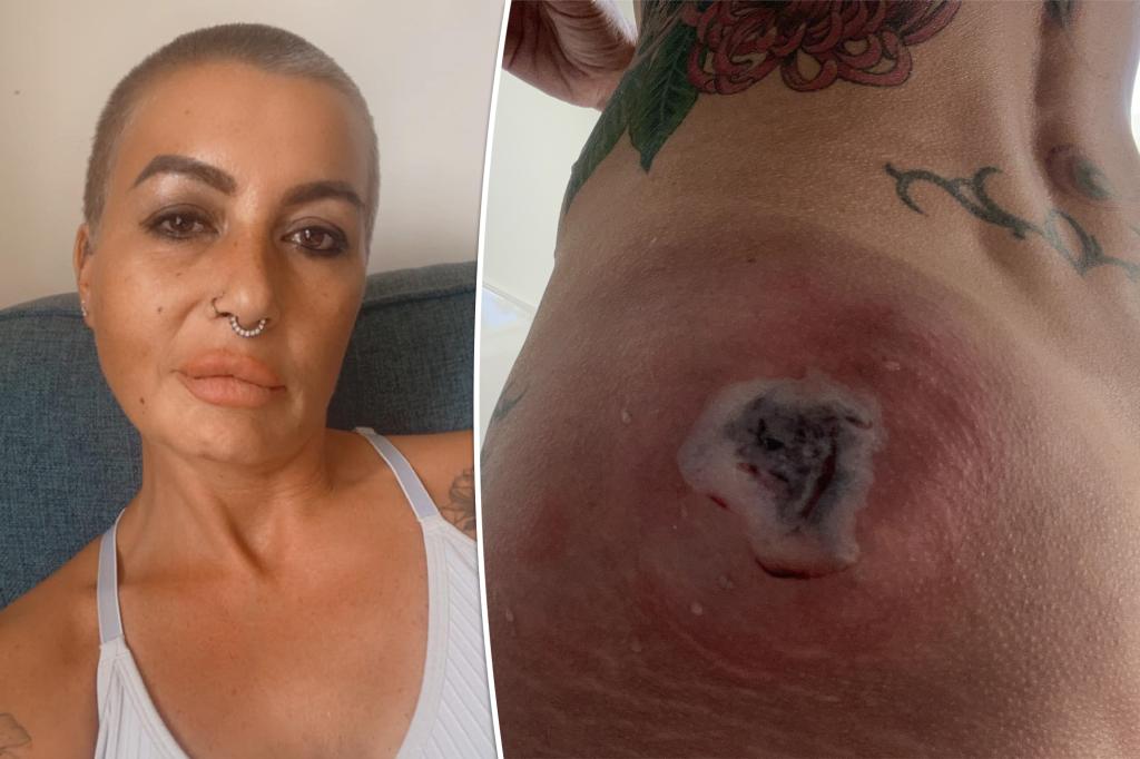 Gym fiend's 'futile' quest for big booty fails - Brazilian butt lift leaves woman 'rotting from the inside out'